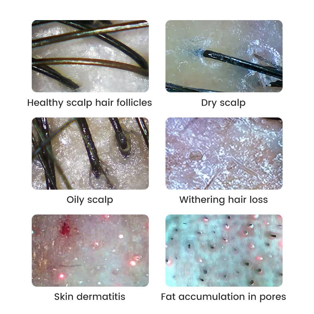 500X Magnification Digital Microscope 2MP Magnifying Glass Electronics Repair Video Coins Microscopio Handheld Dermatoscope Skin Analyzer Machine