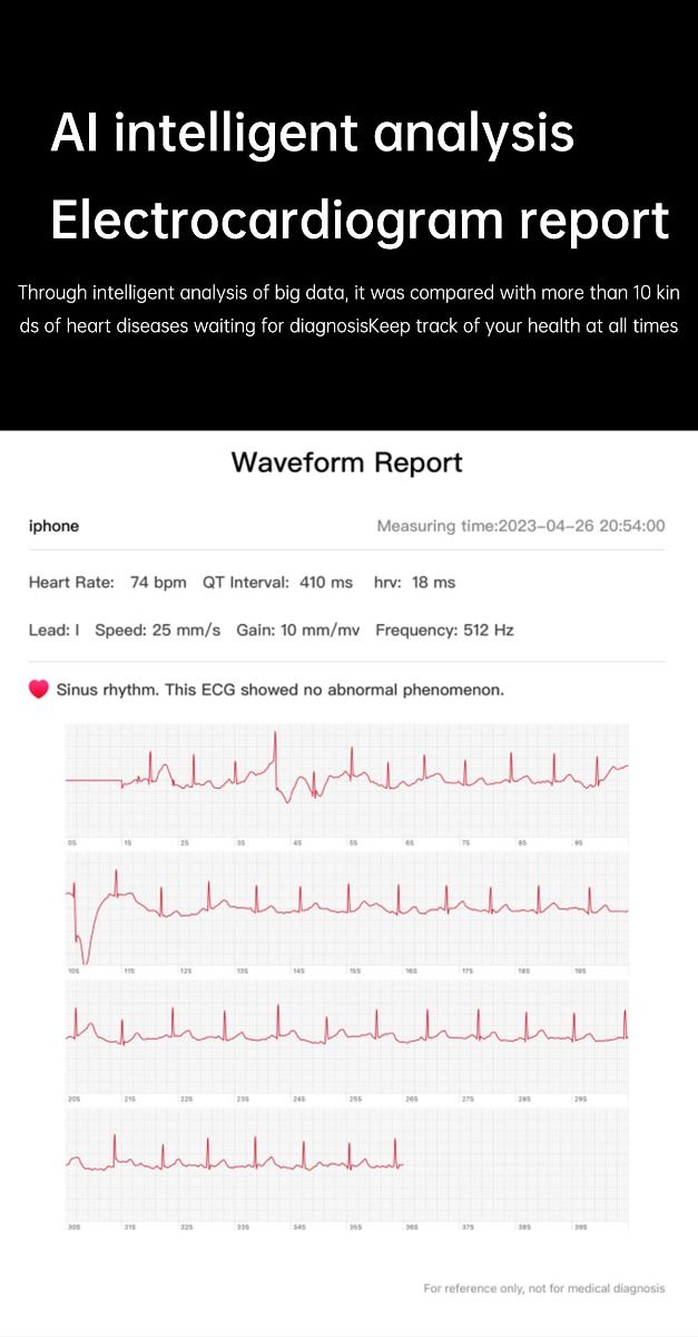 ET540 Blood glucose ECG Body temperature Blood pressure Blood oxygen Heart rate Bluetooth call Smartwatch Fitness Tracker