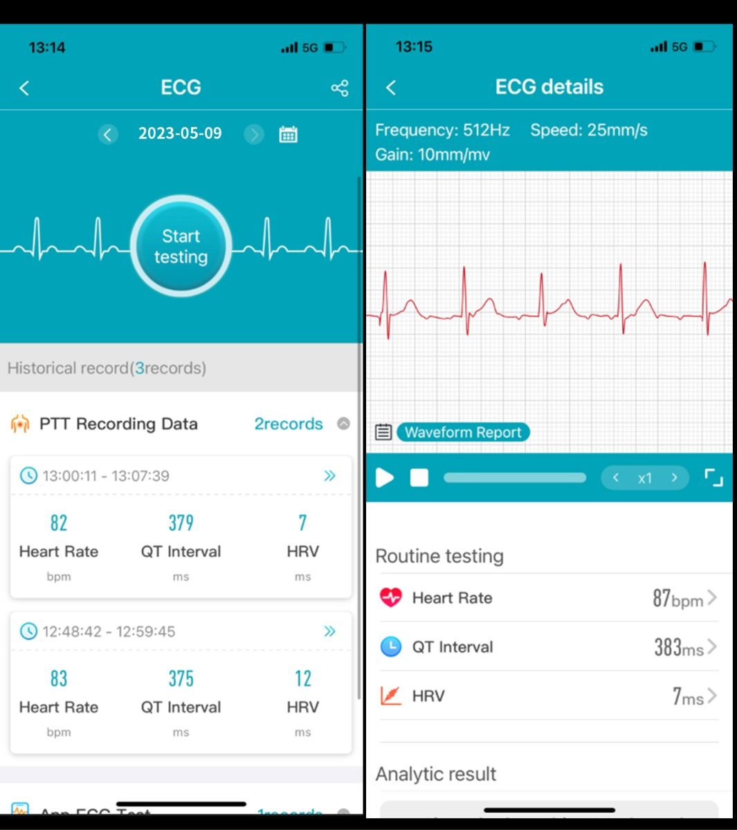 ET540 Blood glucose ECG Body temperature Blood pressure Blood oxygen Heart rate Bluetooth call Smartwatch Fitness Tracker